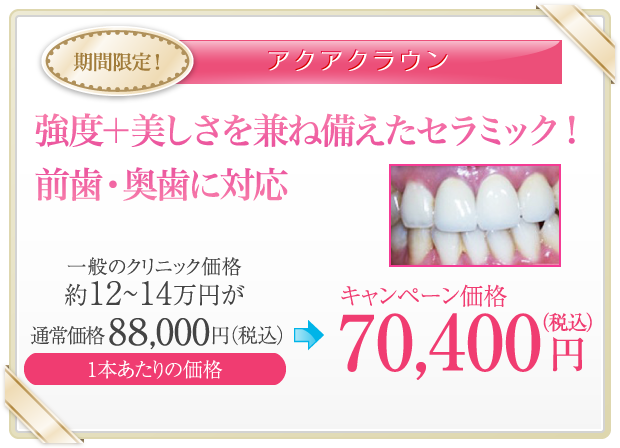 期間限定！アクアクラウン 通常価格88,000円→キャンペーン価格70,400円