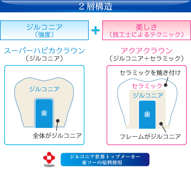 2層構造：ジルコニア（強度）＋美しさ（技工士によるテクニック）