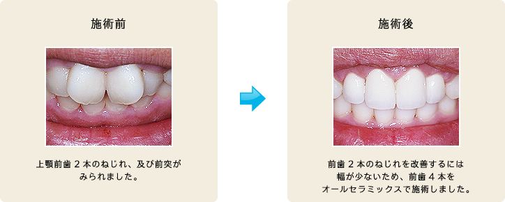 施術前/施術後