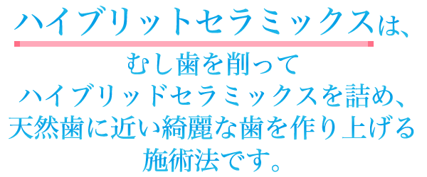 ハイブリットセラミックスは、ムシ歯を削ってハイブリットセラミックスを詰め、天然歯に近い綺麗な歯を作り上げる施術法です。