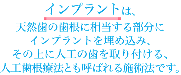 インプラントは、天然歯の歯根に相当する部分にインプラントを埋め込み、その上に人工の歯を取り付ける、人工歯根療法とも呼ばれる施術法です。